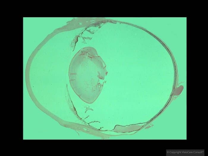 Anatomy of dog's eye