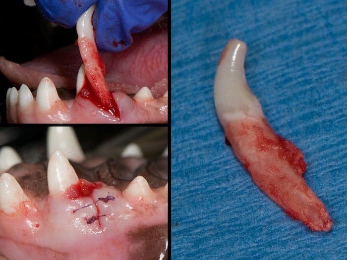 deciduous extraction