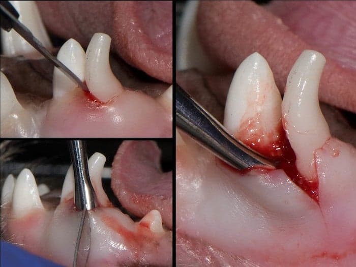 deciduous canine extraction