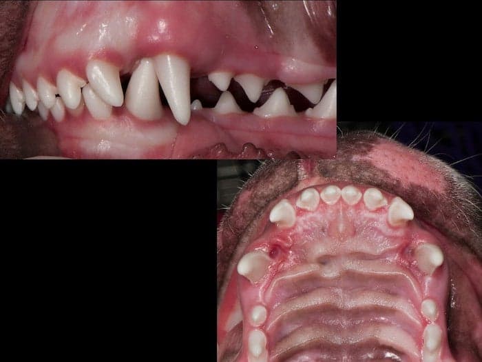 Impingement and gum damage