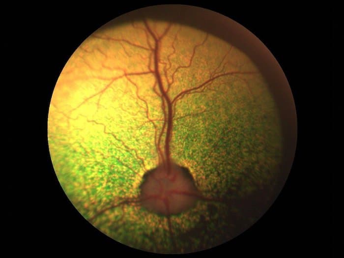 normal dog fundus
